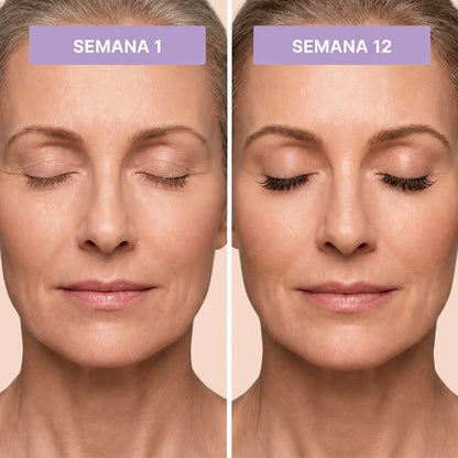 Velmadora™ Lash Serum – Longer, Fuller, Stronger Lashes