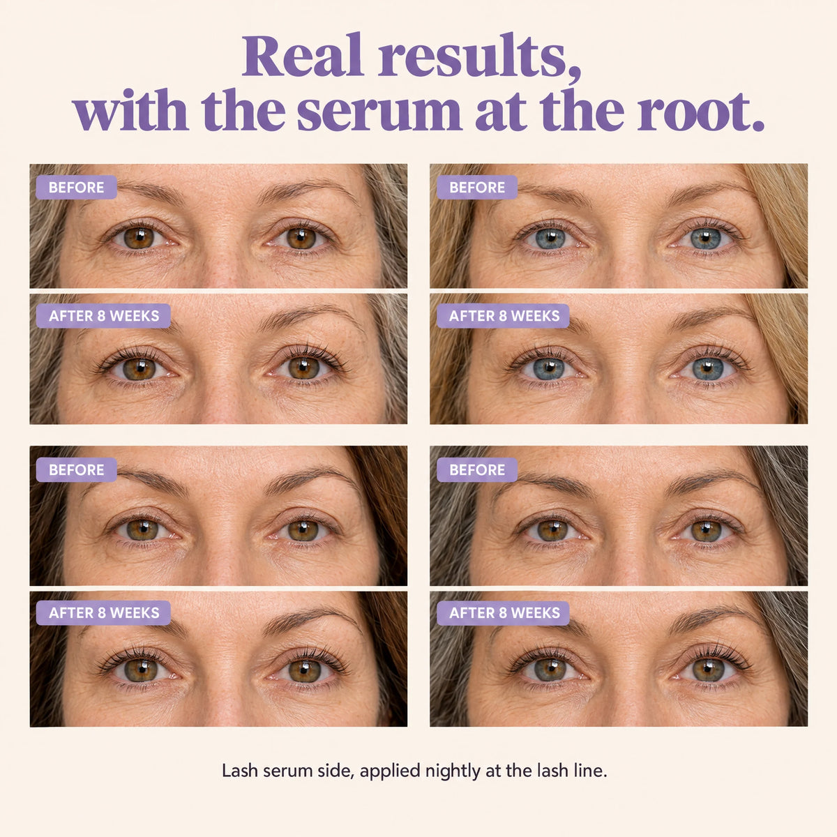 Real results with the serum at the root: before and after 8 weeks